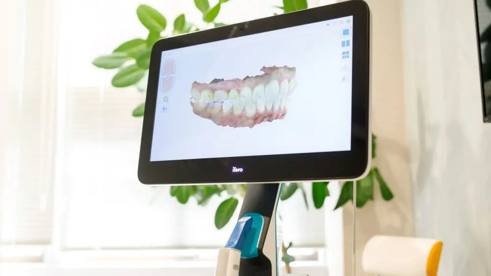 山片矯正歯科 特長の画像