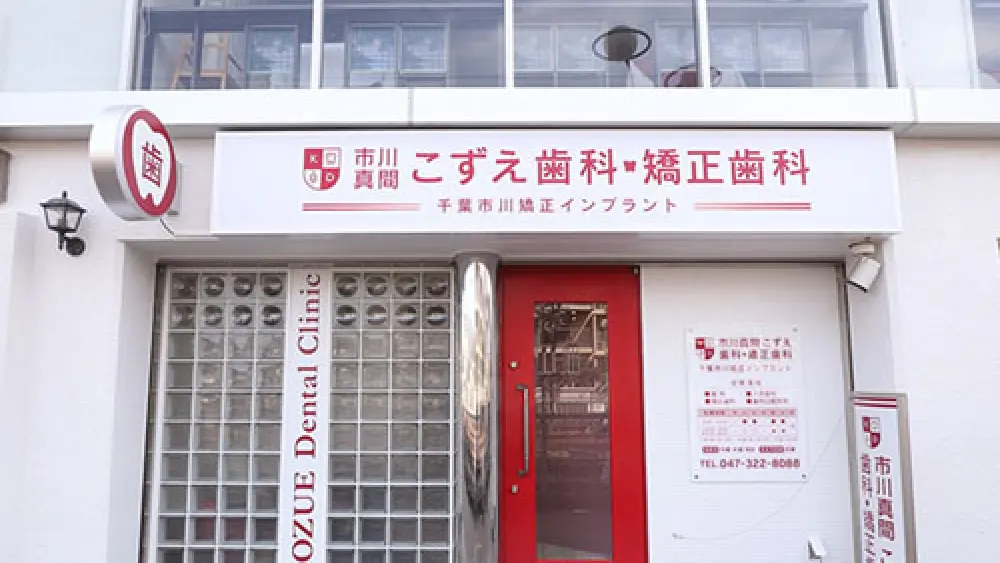 市川真間こずえ歯科・矯正歯科 マウスピース矯正の画像