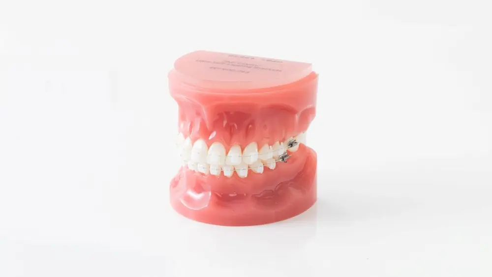 中野駅ウエスト矯正歯科 矯正歯科 その4の画像