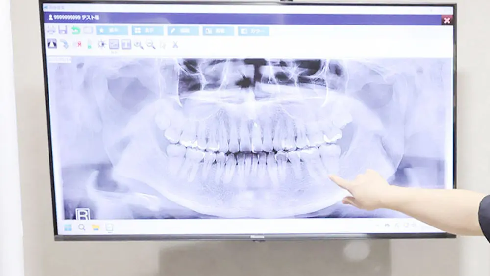 宇部TCデンタルクリニック 小児矯正 その4の画像