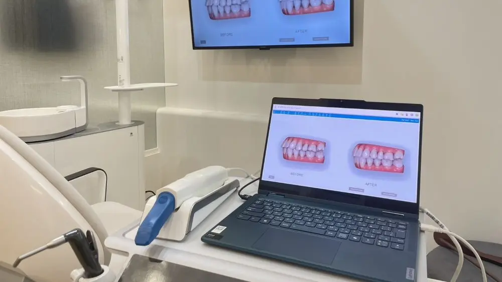 新宿アミリア矯正歯科 特長の画像