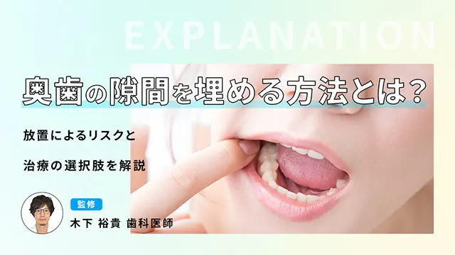 奥歯の隙間を埋める方法とは？放置によるリスクと治療の選択肢を解説の画像