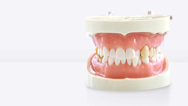 歯並びが急に悪くなった原因は？の画像