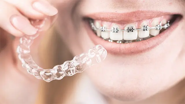 歯並びを根本的に治す、専門的な治療法とその選択肢の画像