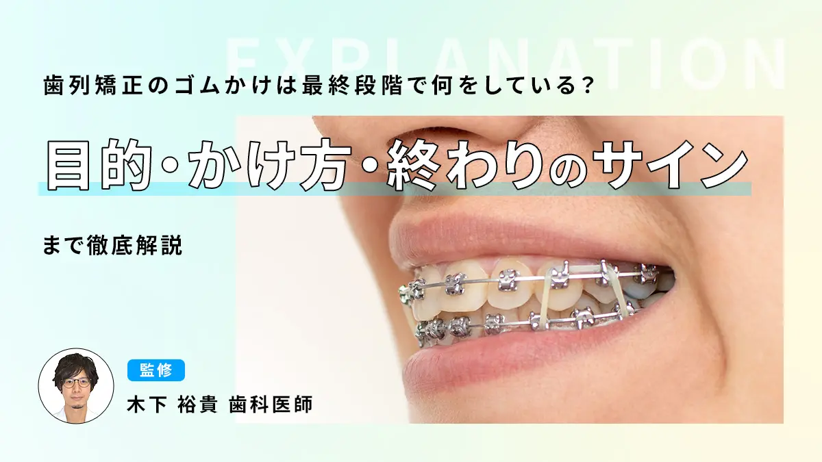 歯列矯正のゴムかけは最終段階で何をしている？目的・かけ方・終わりのサインまで徹底解説の画像