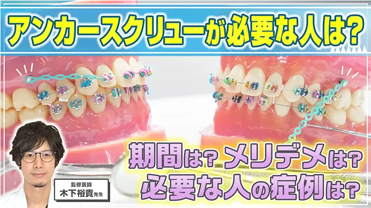 アンカースクリューが必要な人は？メリット・デメリット、費用や期間について解説のサムネイル画像