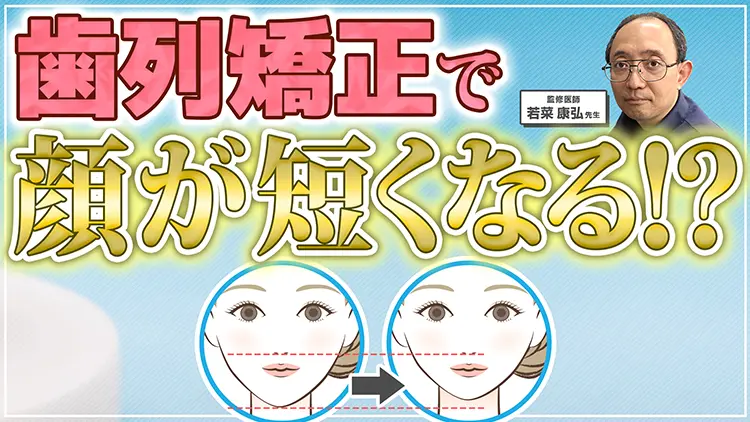 【歯科医師が解説】アンカースクリューで顔は本当に短くなる？顔の変化のメカニズムと期待できるケースを解説のサムネイル画像