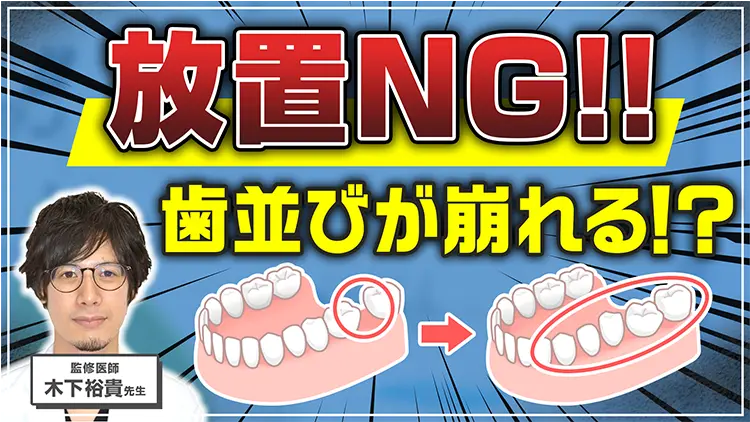 【歯科医師が解説】歯並び悪化の原因に？奥歯の隙間を今すぐ治すべき理由のサムネイル画像