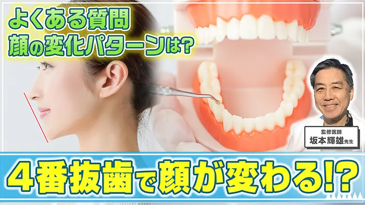 【歯科医師が解説】4番抜歯で顔が変わる！？変化のパターンとよくある質問を徹底解説！のサムネイル画像