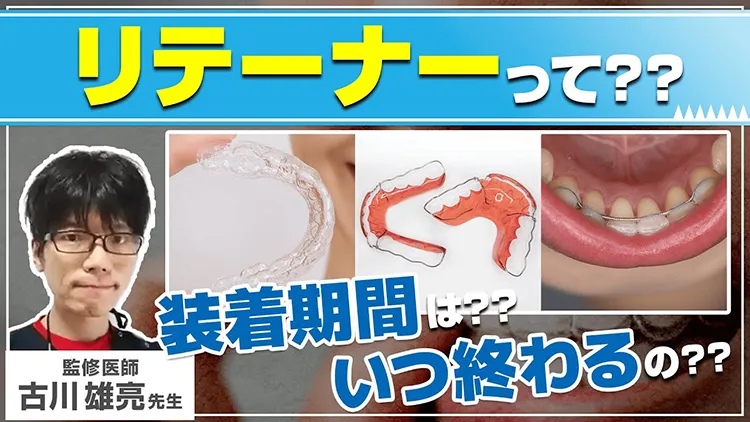 リテーナーの使用期間とよくあるトラブルを徹底解説!のサムネイル画像