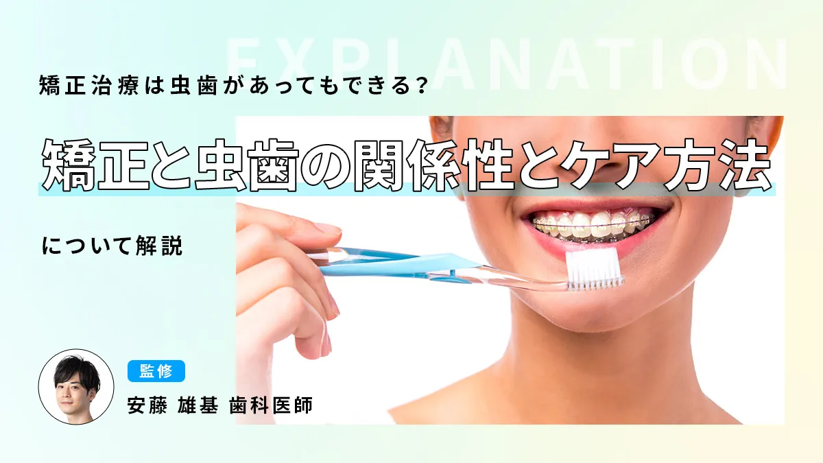矯正治療は虫歯があってもできる？矯正と虫歯の関係性とケア方法について解説の画像