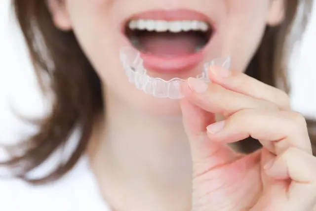 矯正中の歯が虫歯になりやすい原因をケース別に解説の画像