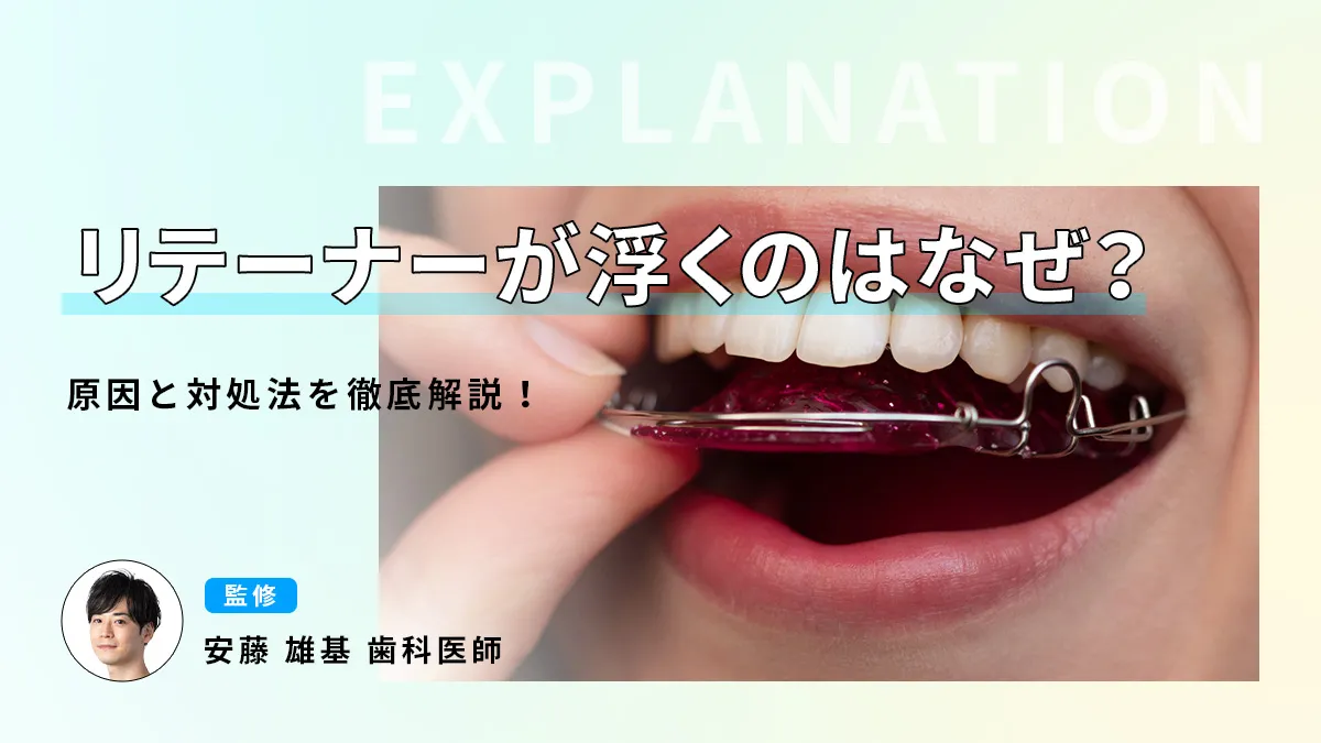 リテーナーが浮くのはなぜ？原因と対処法を徹底解説！の画像