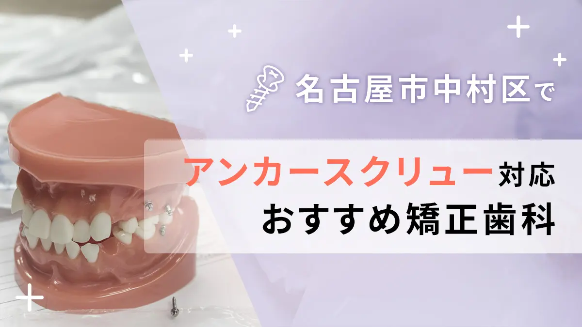 名古屋市中村区でアンカースクリュー対応のおすすめ矯正歯科5選の画像