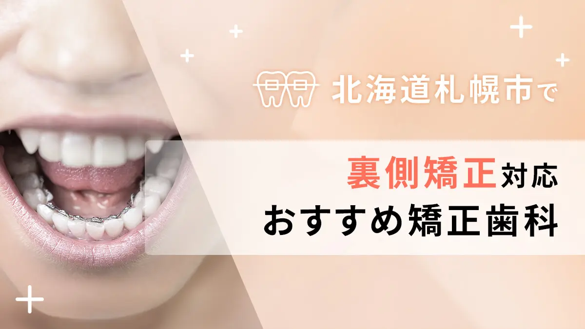 北海道札幌市で裏側矯正対応のおすすめ矯正歯科5選の画像