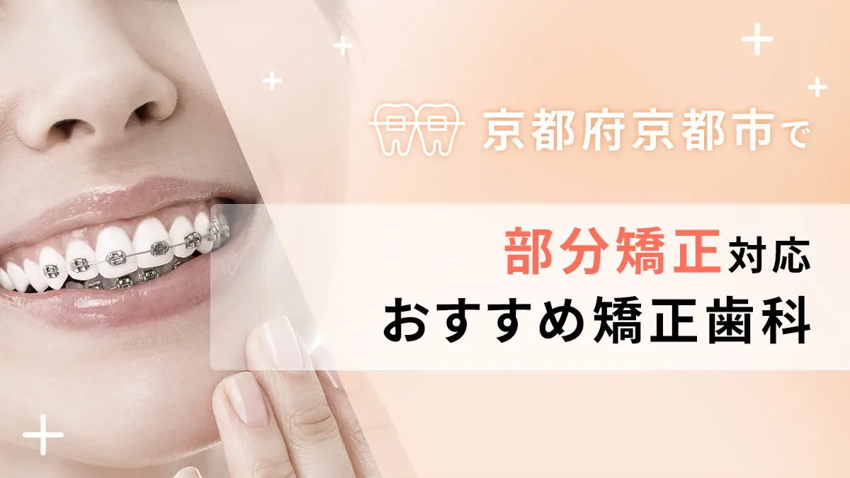 京都府京都市で部分矯正対応のおすすめ矯正歯科5選の画像