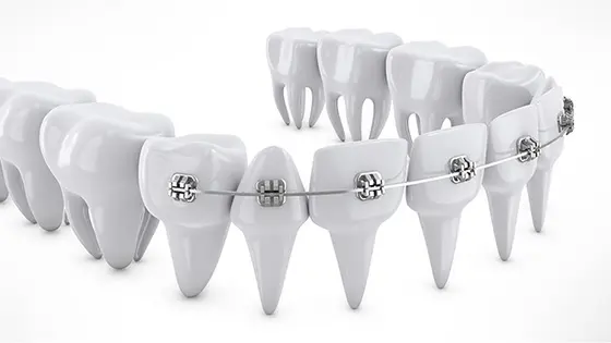 部分矯正でおすすめの矯正歯科医院の画像