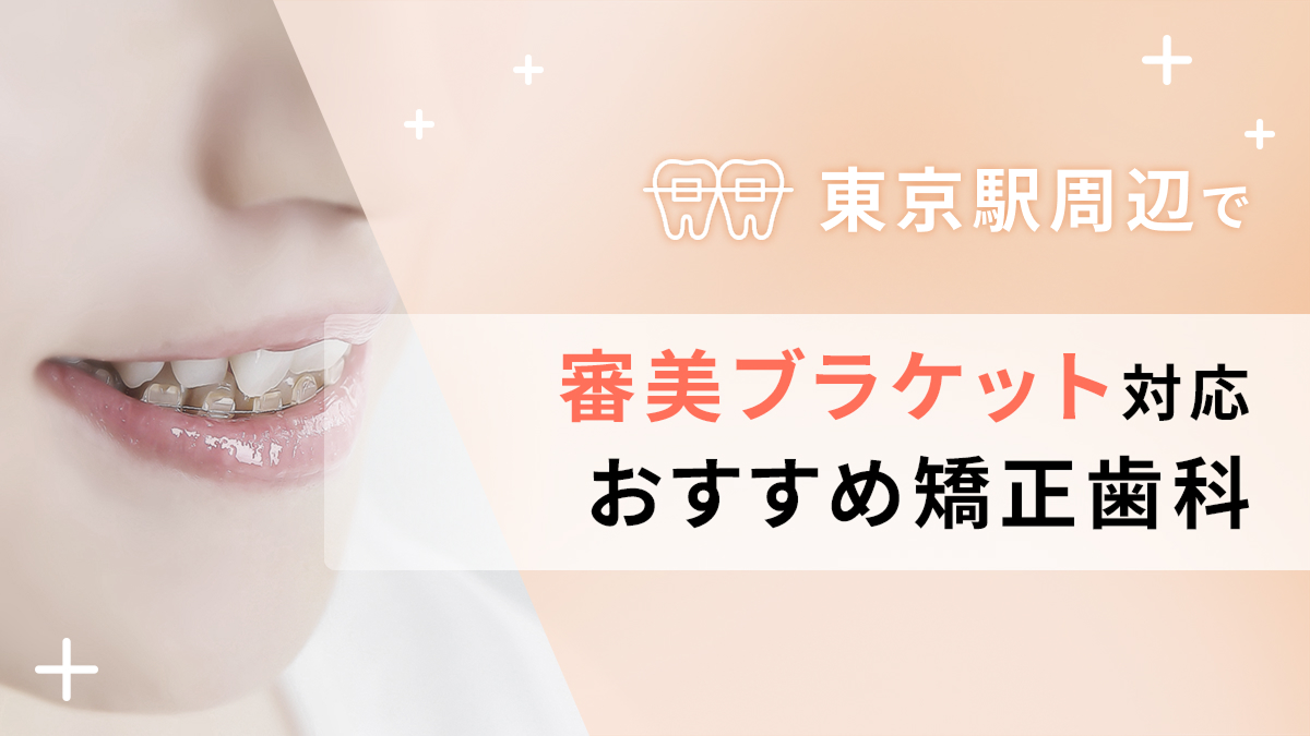 東京駅周辺で審美ブラケット対応のおすすめ矯正歯科5選の画像